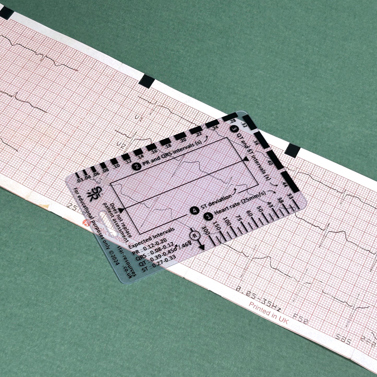 ECG Reader ID Badge Flashcard - Pocket Paramedic Guide for Student Paramedics