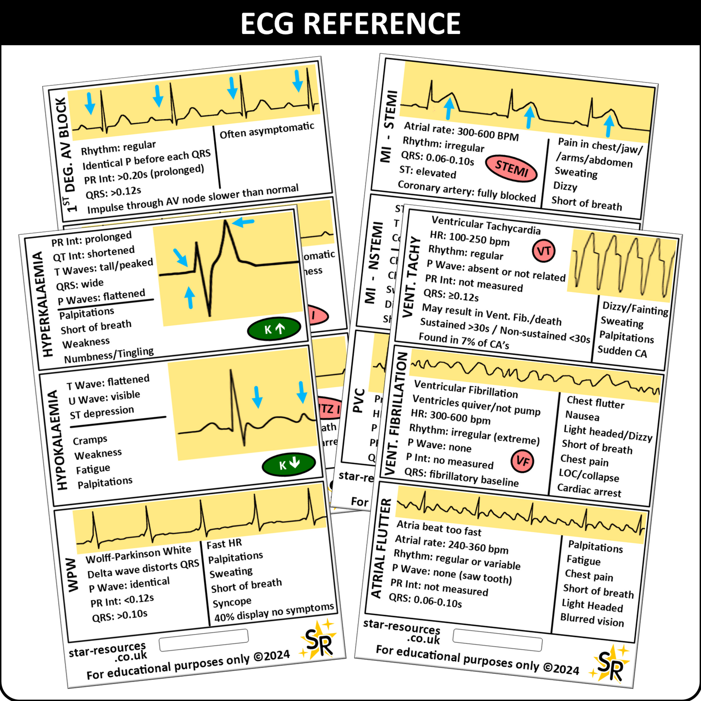 ECG Reference ID Badge Cards - Student Paramedics Ambulance