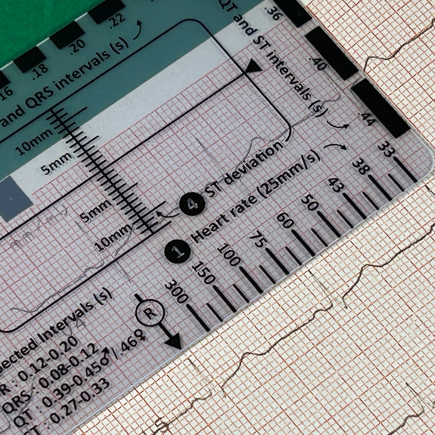 ECG Reader ID Badge Flashcard - Pocket Paramedic Guide for Student Paramedics