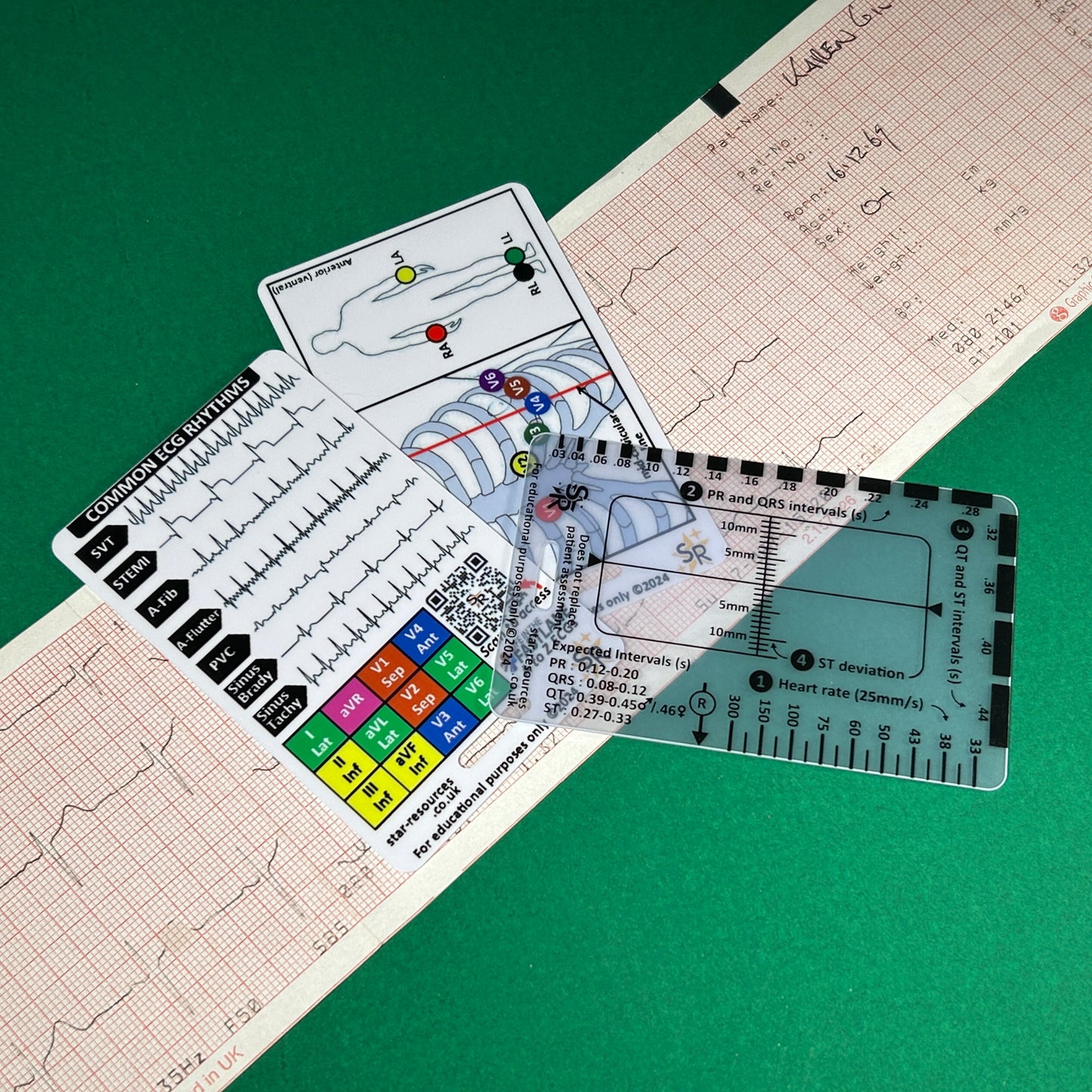 ECG Reader ID Badge Flashcard - Pocket Paramedic Guide for Student Paramedics