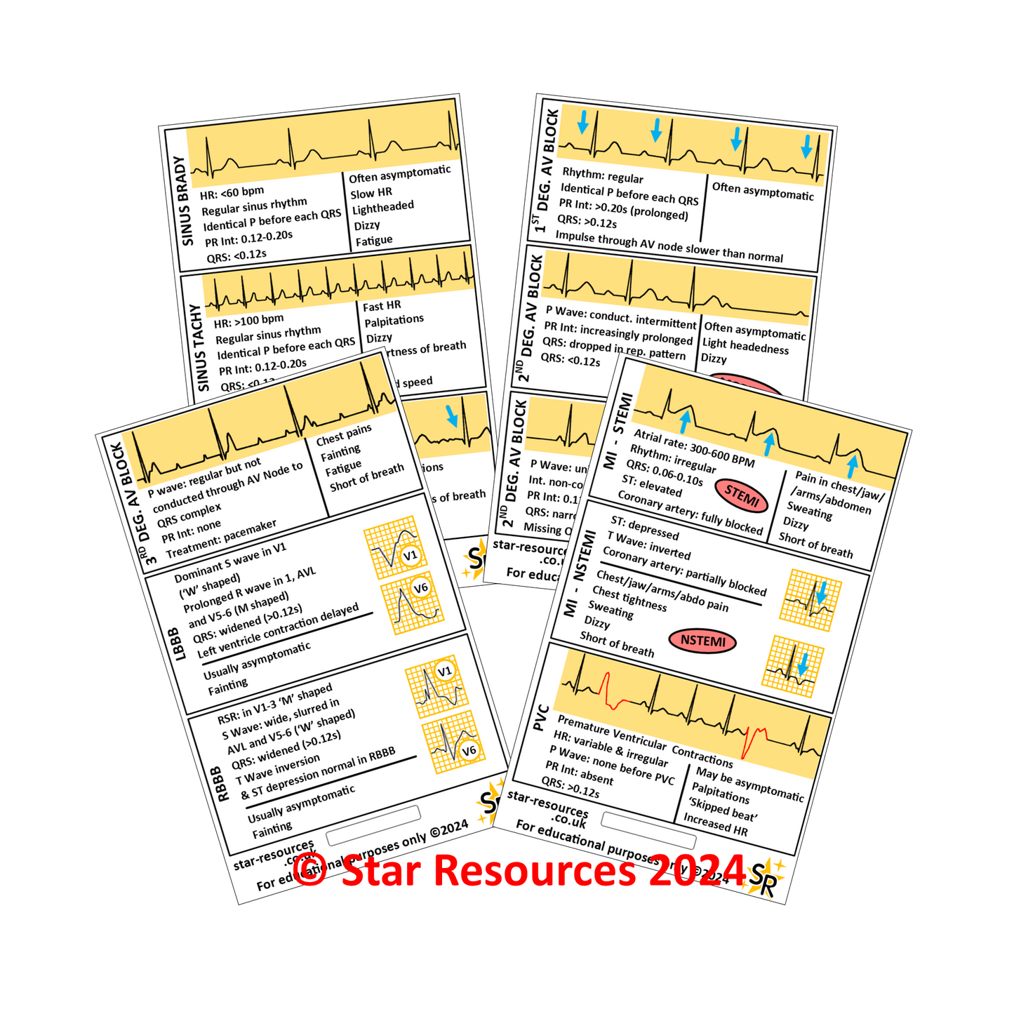 ECG Reference ID Badge Cards - Student Paramedics Ambulance