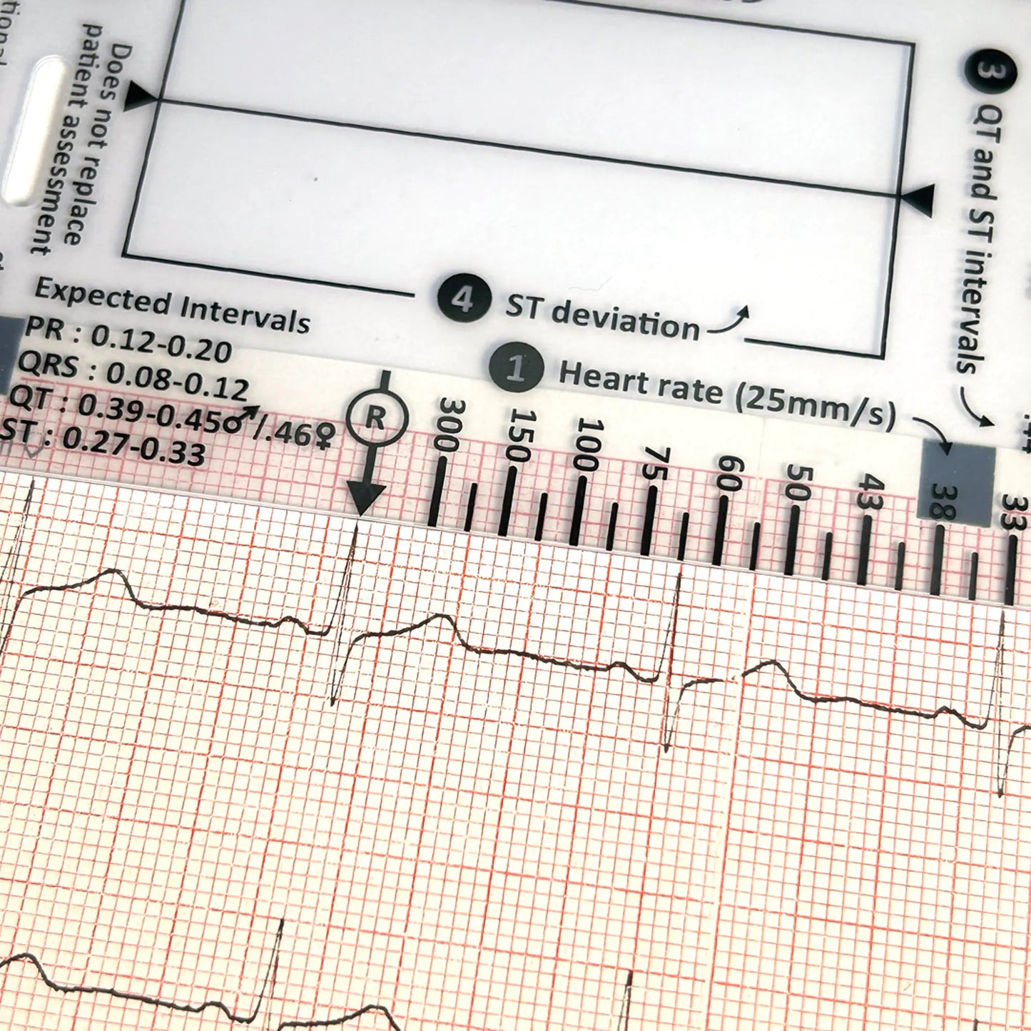 ECG Reader ID Badge Flashcard - Pocket Paramedic Guide for Student Paramedics