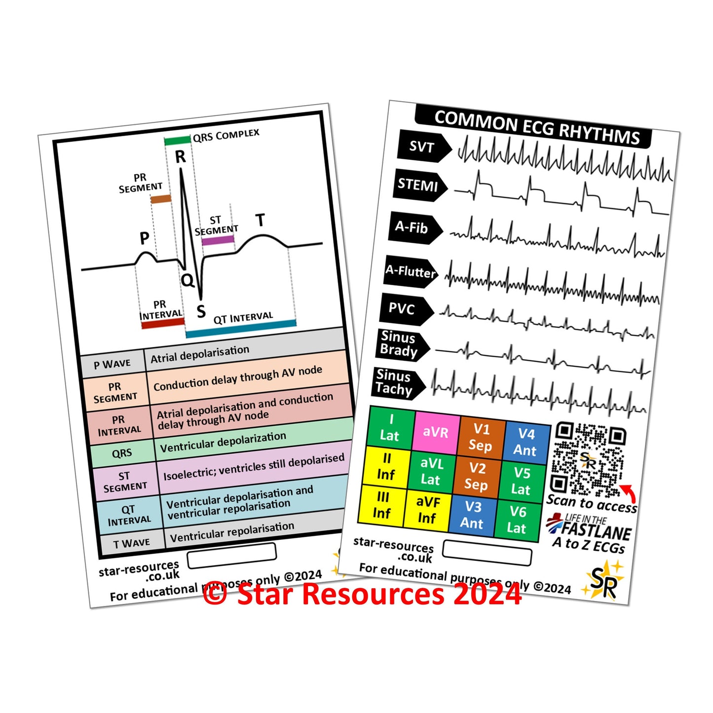 ECG Rhythms ID Badge Card